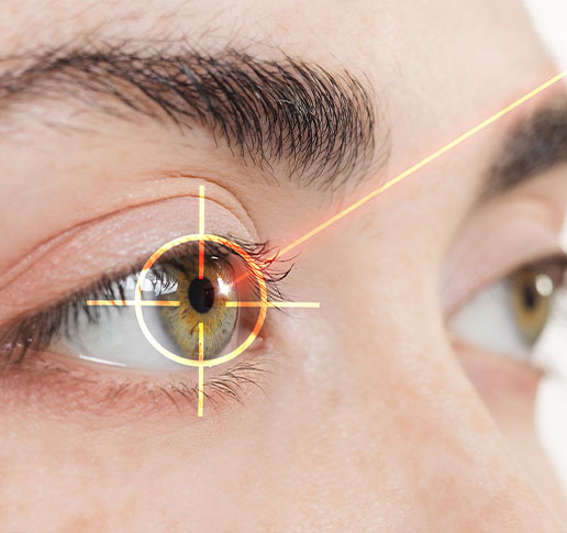 Laser Eye Surgery